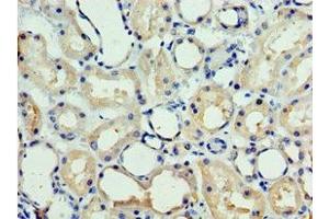 Immunohistochemistry of paraffin-embedded human kidney tissue using ABIN7147719 at dilution of 1:100 (CHD2 抗体  (AA 1569-1828))