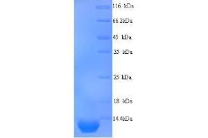 SDS-PAGE (SDS) image for Peptidase Inhibitor 3, Skin-Derived (PI3) (AA 61-117) protein (His tag) (ABIN5713726)