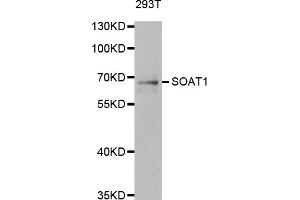 Western blot analysis of extracts of 293T cells, using SOAT1 antibody. (SOAT1 抗体)