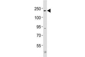 Western blot testing of Alk antibody at 1:2000 dilution + mouse cerebellum lysate; Predicted molecular weight: 190-220 kDa. (ALK 抗体  (AA 1517-1550))