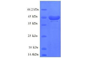 SDS-PAGE (SDS) image for Ribosomal Protein S14 (RPS14) (AA 2-146), (partial) protein (GST tag) (ABIN1046364)