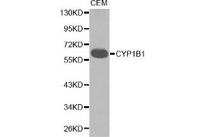 Western blot analysis of extracts of CEM cell lines, using CYP1B1 antibody. (CYP1B1 抗体)