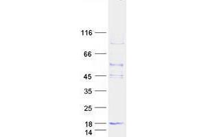 Validation with Western Blot