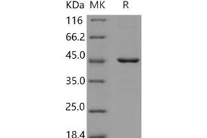 HDAC8 Protein (His tag)