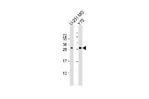 All lanes : Anti-PK1IP1L Antibody (Center) at 1:1000 dilution Lane 1: U-251 MG whole cell lysate Lane 2: Y79 whole cell lysate Lysates/proteins at 20 μg per lane. (MAPK1IP1L 抗体  (AA 108-137))