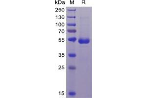 Human CD70 Protein, mFc-His Tag on SDS-PAGE under reducing condition. (CD70 Protein (mFc-His Tag))