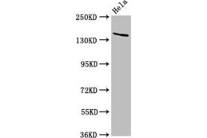 Western Blot Positive WB detected in: Hela whole cell lysate All lanes: LAMC2 antibody at 5 μg/mL Secondary Goat polyclonal to rabbit IgG at 1/50000 dilution Predicted band size: 131, 122 kDa Observed band size: 140 kDa (LAMC2 抗体  (AA 417-588))
