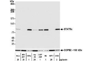 Western Blotting (WB) image for anti-Signal Transducer and Activator of Transcription 5A (STAT5A) (AA 744-794) antibody (ABIN7454017)