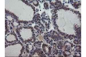 Image no. 8 for anti-Prefoldin Subunit 3 (PFDN3) antibody (ABIN1501705)