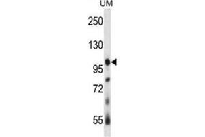 USP4 Antibody (N-term) western blot analysis in human uterine tumor tissue lysates (35 µg/lane). (USP4 抗体  (N-Term))