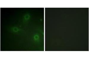 Immunofluorescence analysis of HeLa cells, using p47 phox (Ab-304) Antibody. (NCF1 抗体  (AA 281-330))
