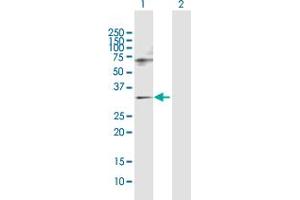 Western Blot analysis of SNF8 expression in transfected 293T cell line by SNF8 MaxPab polyclonal antibody. (SNF8 抗体  (AA 1-258))