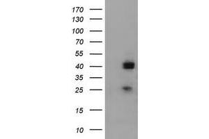 Western Blotting (WB) image for anti-alpha-1,4-N-Acetylglucosaminyltransferase (A4GNT) (AA 121-340) antibody (ABIN2715585) (A4GNT 抗体  (AA 121-340))