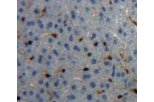 IHC-P analysis of liver tissue, with DAB staining. (CPB2 抗体  (AA 309-374))