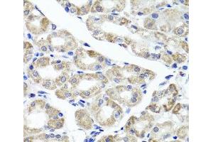 Immunohistochemistry of paraffin-embedded Human stomach using MAPKBP1 Polyclonal Antibody at dilution of 1:100 (40x lens). (MAPKBP1 抗体)