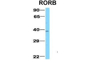 Host:  Rabbit  Target Name:  RORB  Sample Type:  Human Fetal Lung  Antibody Dilution:  1. (RORB 抗体  (C-Term))