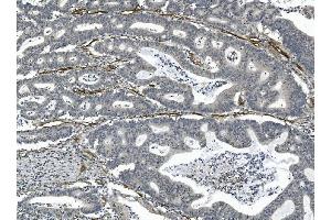 IHC analysis of CD146 using anti-CD146 antibody (ABIN7602097).