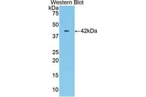 Western blot analysis of the recombinant protein. (CPB2 抗体  (AA 113-422))