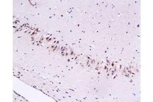 Formalin-fixed and paraffin embedded rat brain tissue labeled with Anti-Cygb Polyclonal Antibody , Unconjugated at 1:200, followed by conjugation to the secondary antibody and DAB staining (CYGB 抗体  (AA 87-132))