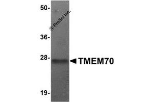 Western Blotting (WB) image for anti-Transmembrane Protein 70 (TMM70) (Middle Region) antibody (ABIN1031136)