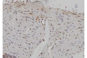 ABIN6276998 at 1/100 staining Human gastric tissue by IHC-P. (Importin 5 抗体)