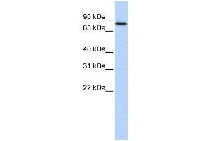 WB Suggested Anti-ADARB2 Antibody Titration:  0. (ADARB2 抗体  (Middle Region))