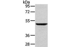 Western Blot analysis of Mouse lung tissue using WASF2 Polyclonal Antibody at dilution of 1/200 (WASF2 抗体)