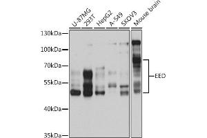 Western blot analysis of extracts of various cell lines, using EED antibody (ABIN6127866, ABIN6139942, ABIN6139945 and ABIN6221014) at 1:1000 dilution. (EED 抗体  (AA 1-300))
