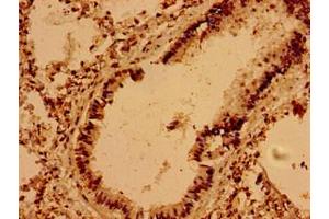 Immunohistochemistry of paraffin-embedded human lung tissue using ABIN7175485 at dilution of 1:100 (VAMP7 抗体  (AA 2-186))