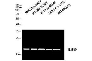 Western Blot (WB) analysis of Mouse Kidney Mouse Heart Mouse Brain Mouse Spleen Rat SPLEEN using IL1F10 antibody. (IL1F10 抗体)