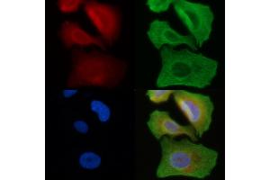 ABIN6258396 and ABIN6274461 staining Hela cells(45 min of heat-shock) by IF/ICC.