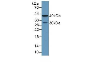 Detection of CPA4 in Human Lung Tissue using Polyclonal Antibody to Carboxypeptidase A4 (CPA4) (CPA4 抗体  (AA 55-421))