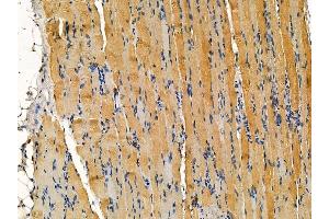 ABIN7095294 and ABIN7099351 at 1/100 staining rat muscle tissue by IHC-P. (CRYbA4 抗体)
