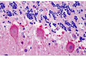 Human Cerebellum: Formalin-Fixed, Paraffin-Embedded (FFPE) (YWHAB 抗体  (AA 34-221))