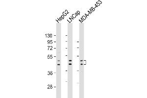 All lanes : Anti-UGT2B4 Antibody (Center) at 1:2000 dilution Lane 1: HepG2 whole cell lysates Lane 2: LNCap whole cell lysates Lane 3: MDA-MB-453 whole cell lysates Lysates/proteins at 20 μg per lane.
