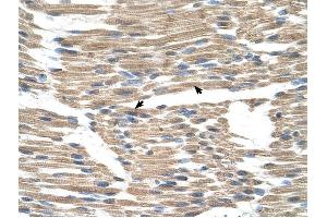 GPR177 antibody was used for immunohistochemistry at a concentration of 4-8 ug/ml to stain Skeletal muscle cells (arrows) in Human Muscle. (GPR177/WLS 抗体  (N-Term))