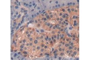IHC-P analysis of Human Tissue, with DAB staining. (GRO gamma 抗体  (AA 35-107))