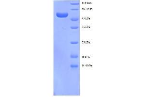 tyrosine 3-Monooxygenase/tryptophan 5-Monooxygenase Activation Protein, beta Polypeptide (YWHAB) (AA 1-246), (full length) protein (GST tag) (YWHAB Protein (AA 1-246, full length) (GST tag))