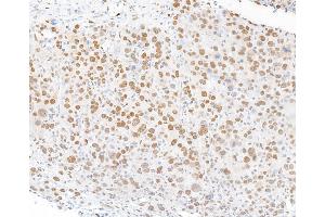 Immunohistochemistry (IHC) image for anti-Forkhead Box P1 (FOXP1) (AA 627-677) antibody (ABIN7454010) (Recombinant FOXP1 抗体  (AA 627-677))