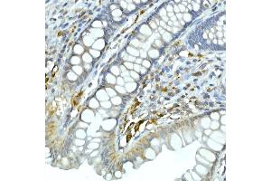 Immunohistochemistry of paraffin-embedded human esophagus using CDK1 Rabbit mAb (ABIN7266576) at dilution of 1:100 (40x lens). (CDK1 抗体)