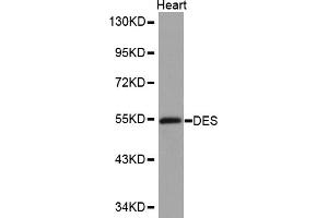 Western blot analysis of extracts of mouse heart, using DES antibody (ABIN5970272). (Desmin 抗体)