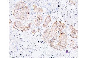 IHC analysis of PDCD6IP using anti-PDCD6IP antibody (ABIN7600490). (ALIX 抗体  (AA 2-330))