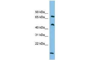 WB Suggested Anti-ECD Antibody Titration: 0. (ECD/SGT1 抗体  (Middle Region))