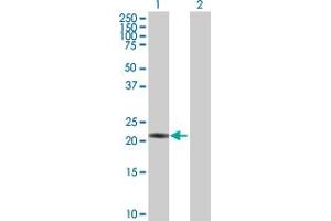 Western Blot analysis of PSMB3 expression in transfected 293T cell line by PSMB3 MaxPab polyclonal antibody. (PSMB3 抗体  (AA 1-205))