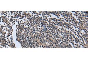 Immunohistochemistry of paraffin-embedded Human tonsil tissue using WNT9B Polyclonal Antibody at dilution of 1:85(x200)