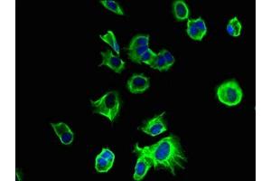 Immunofluorescent analysis of MCF-7 cells using ABIN7173115 at dilution of 1:100 and Alexa Fluor 488-congugated AffiniPure Goat Anti-Rabbit IgG(H+L) (TMEM186 抗体  (AA 124-213))