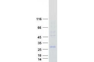 Western Blotting (WB) image for HESX Homeobox 1 (HESX1) protein (Myc-DYKDDDDK Tag) (ABIN2722672)