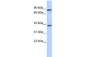 WB Suggested Anti-DHX35 Antibody Titration:  0. (DHX35 抗体  (N-Term))
