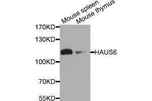 Western blot analysis of extracts of various cell lines, using HAUS6 antibody. (FAM29A 抗体)