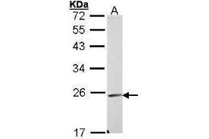 WB Image Sample (30 ug of whole cell lysate) A: A431 , 12% SDS PAGE antibody diluted at 1:1000 (Endomucin 抗体)